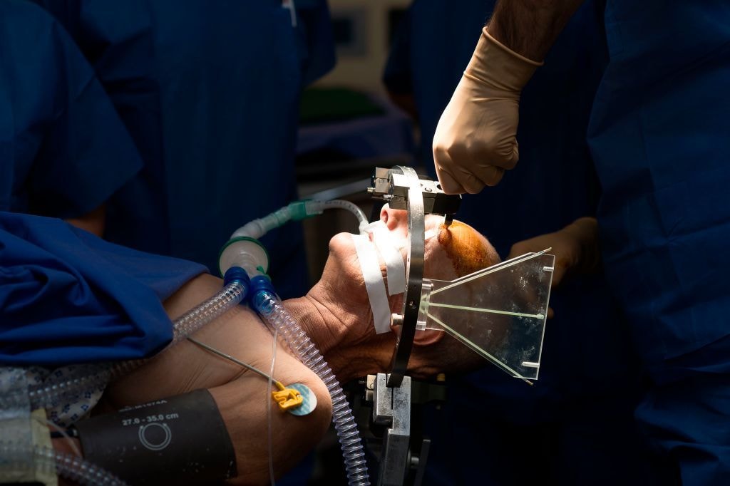 Elektrowstrząsy wracają do łask. Leczenie prądem od choroby Parkinsona po migrenę