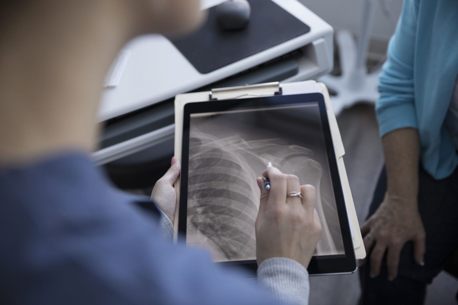 Sarkoidoza. Choroba tajemnicza i podstępna. Często mylona z rakiem