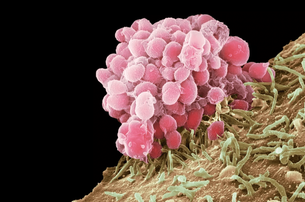 Neisseria gonorrhoeae
