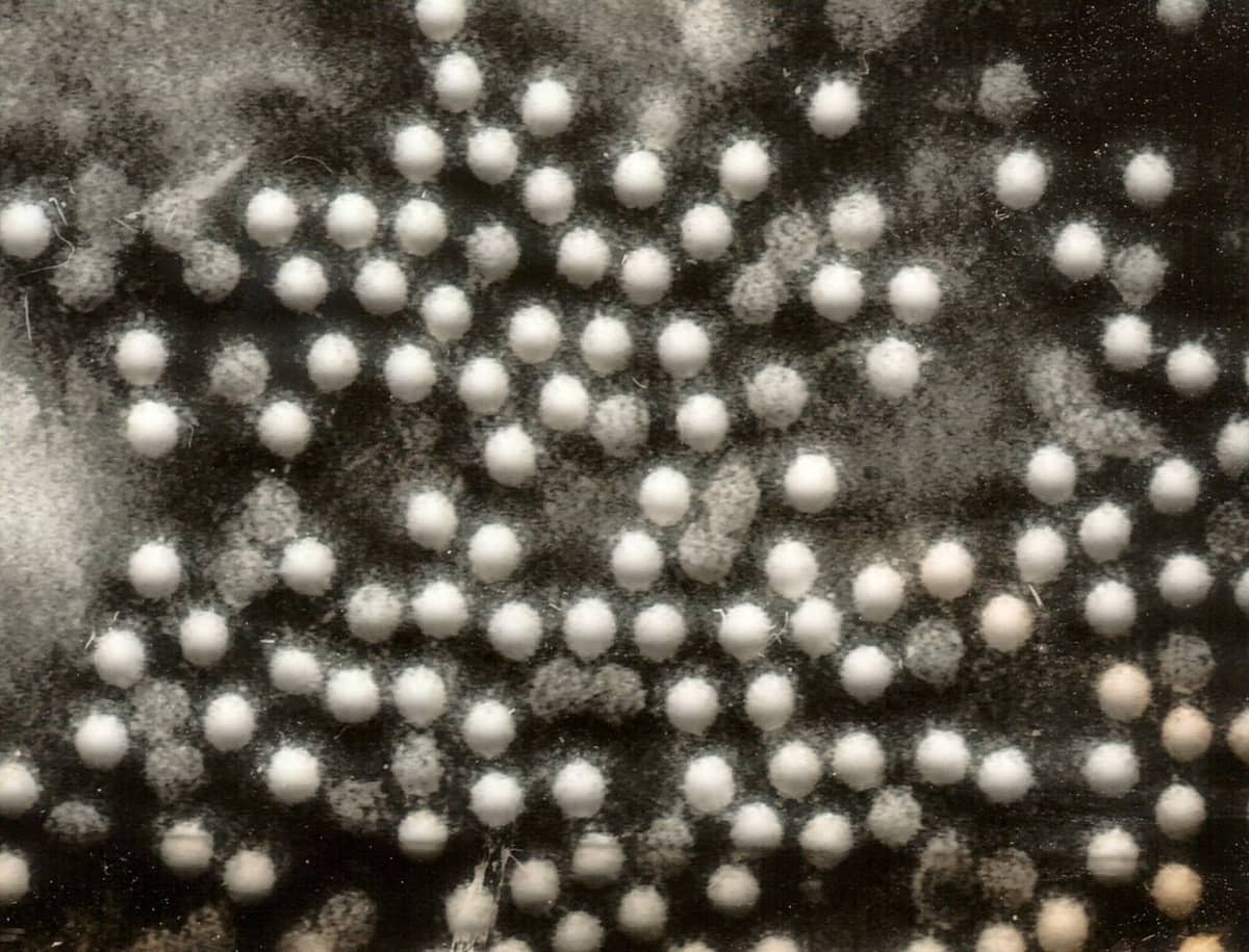 Amerykanie mają problem z polio. Tamtejsze służby medyczne ogłosiły stan wyjątkowy