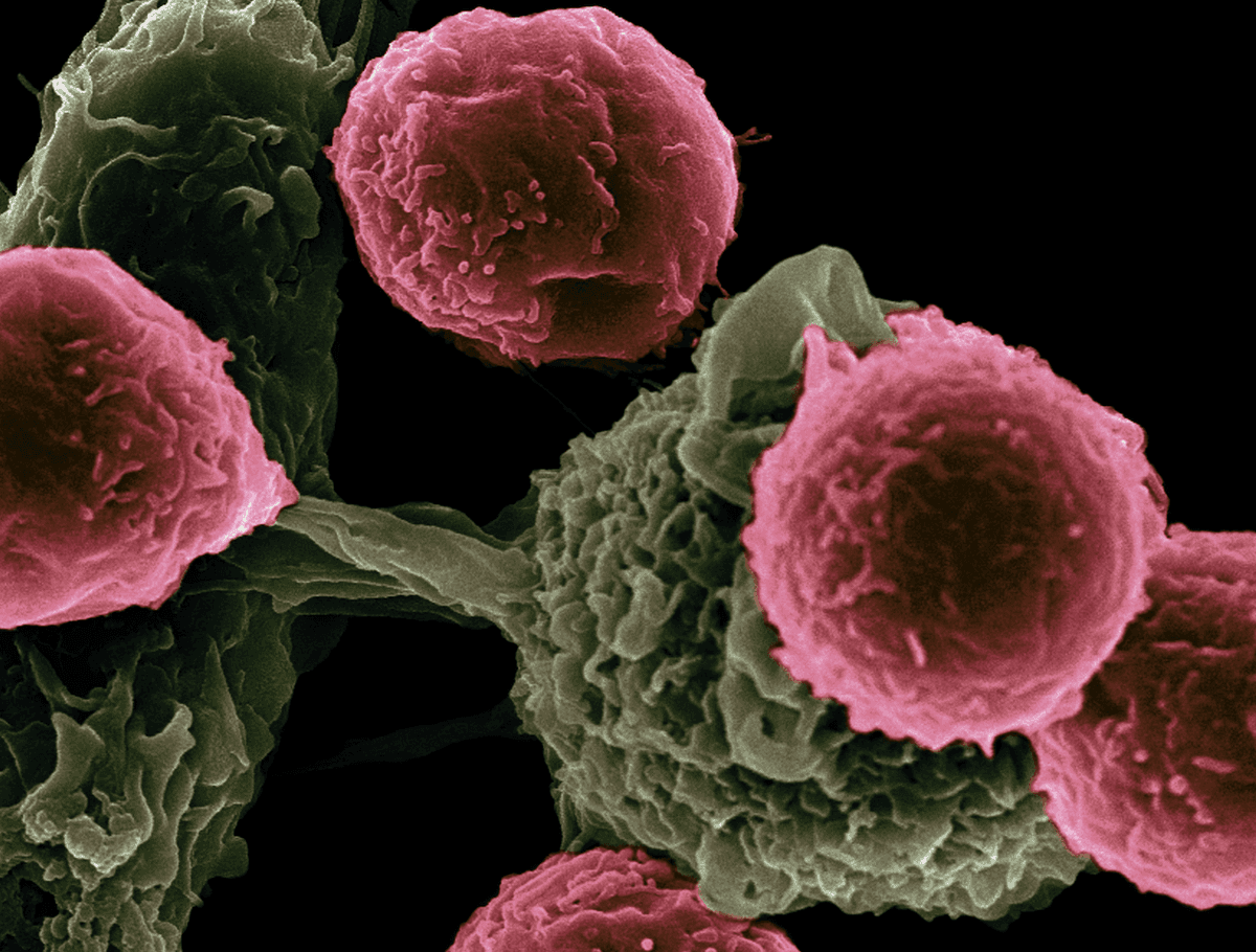 Czy jesteśmy coraz bliżej pokonania czerniaka? /Fot. Unspash, National Cancer Institute
