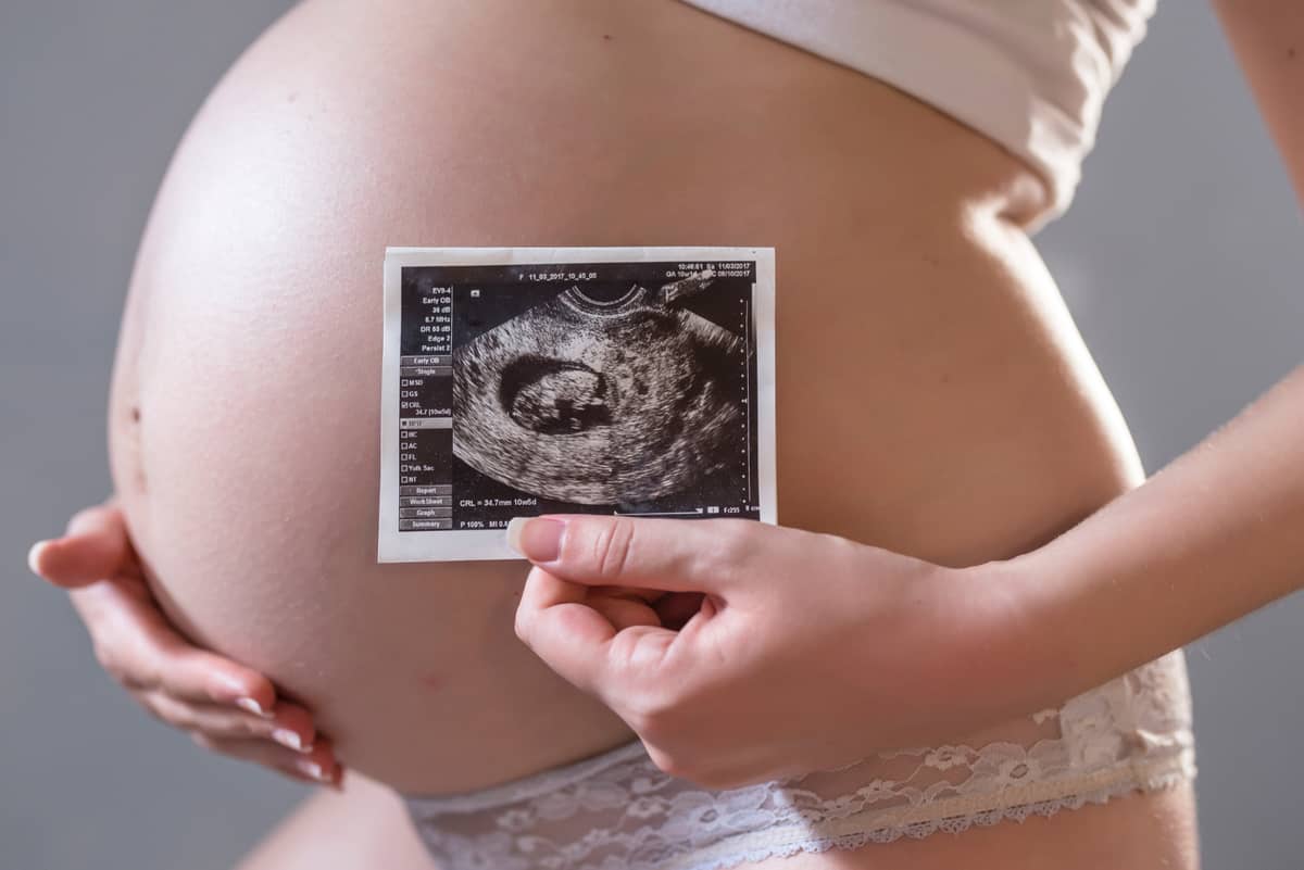 Malformacje żyły Galena często nie są wykrywane prenatalnie /Fot. Freepik
