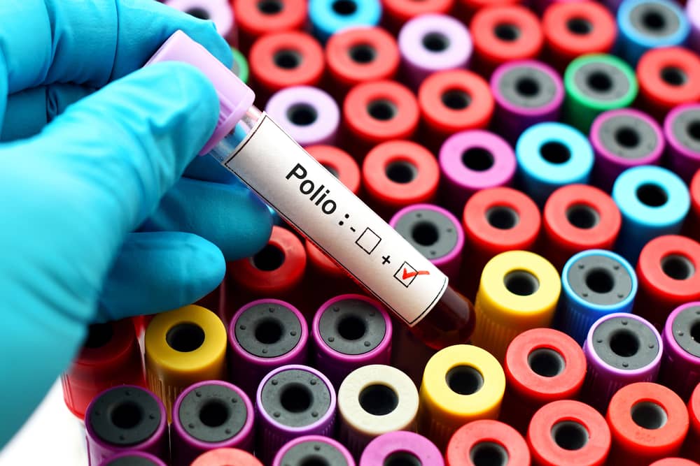 Czy polio może znów nam zagrozić?
