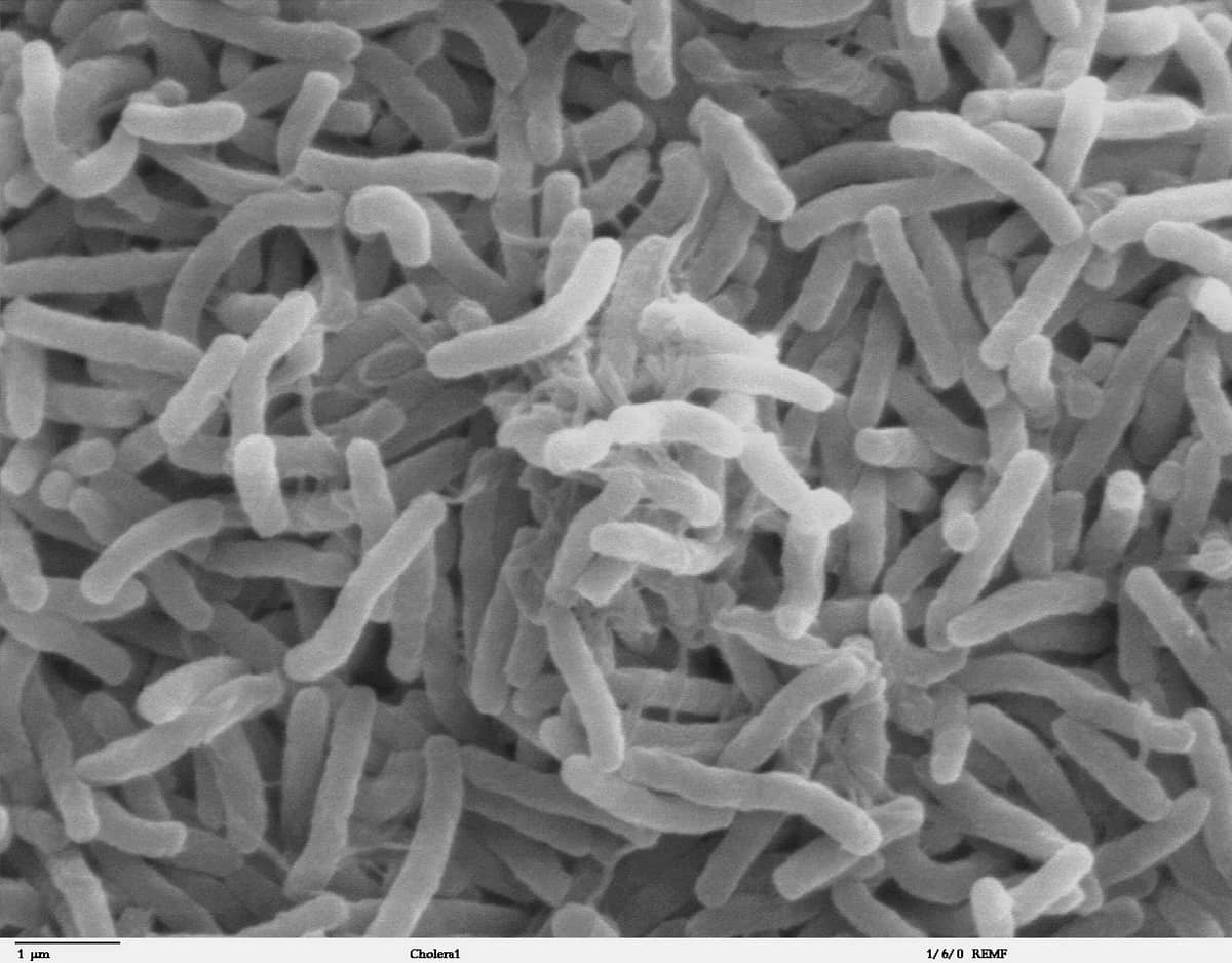 Vibrio cholerae

