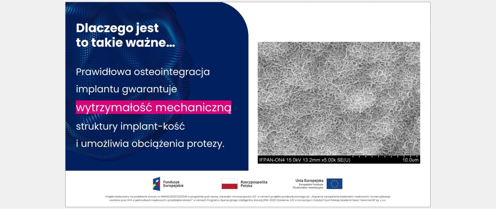 zalety stosowania powłok ALD w implantologii