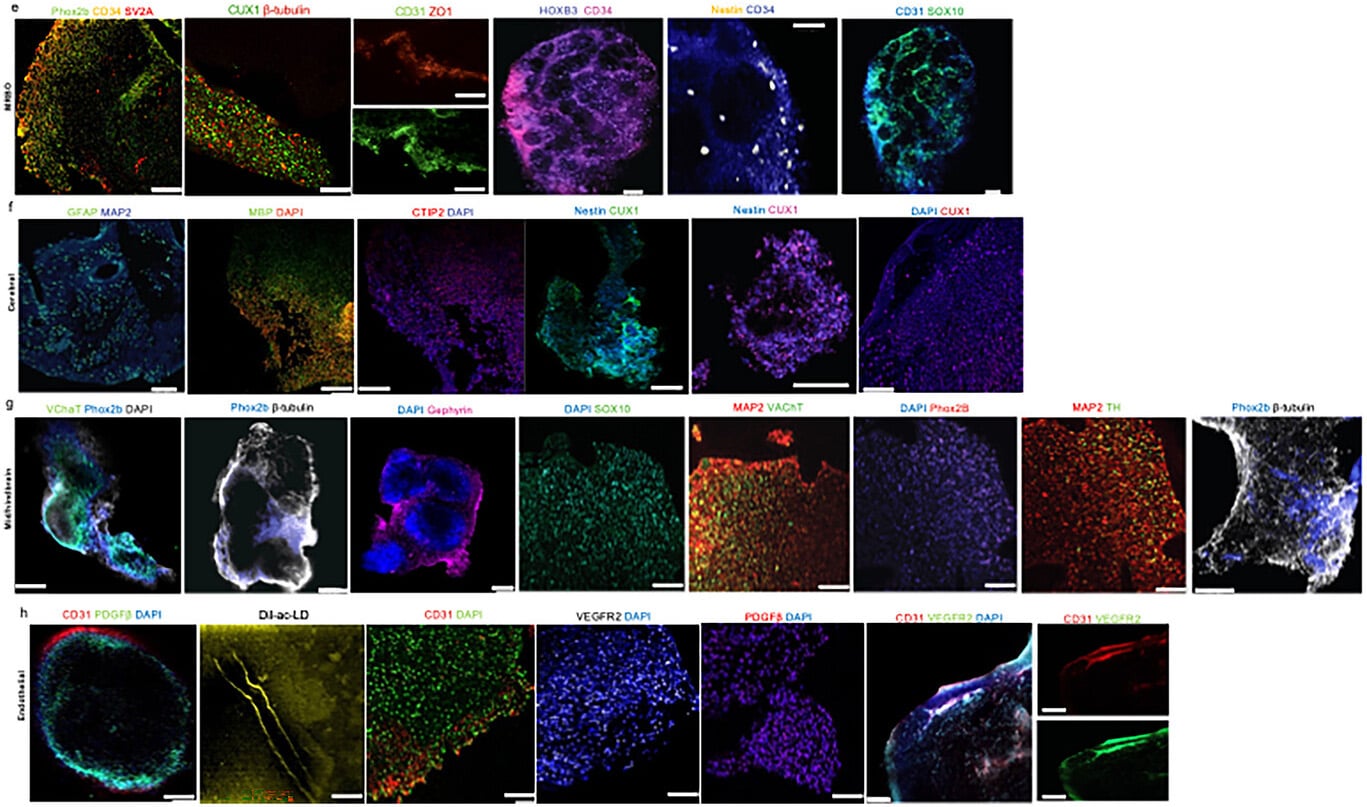 organoid symulujący ludzki mózg