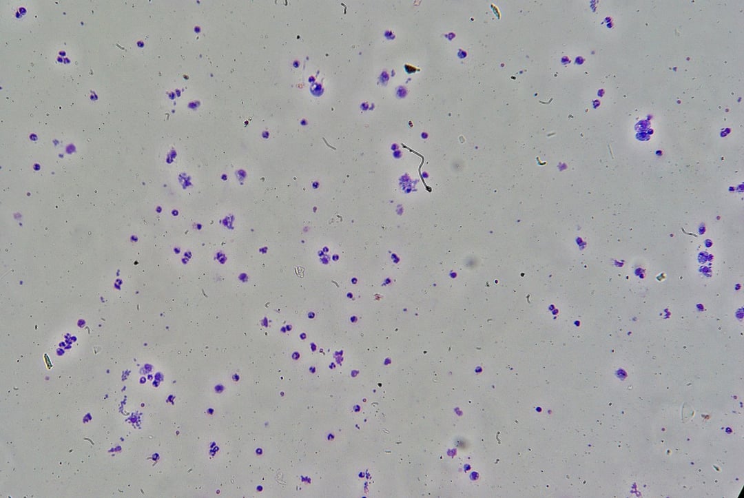 Ten pasożyt wpływa na ludzką atrakcyjność. Ma go nawet połowa z nas
