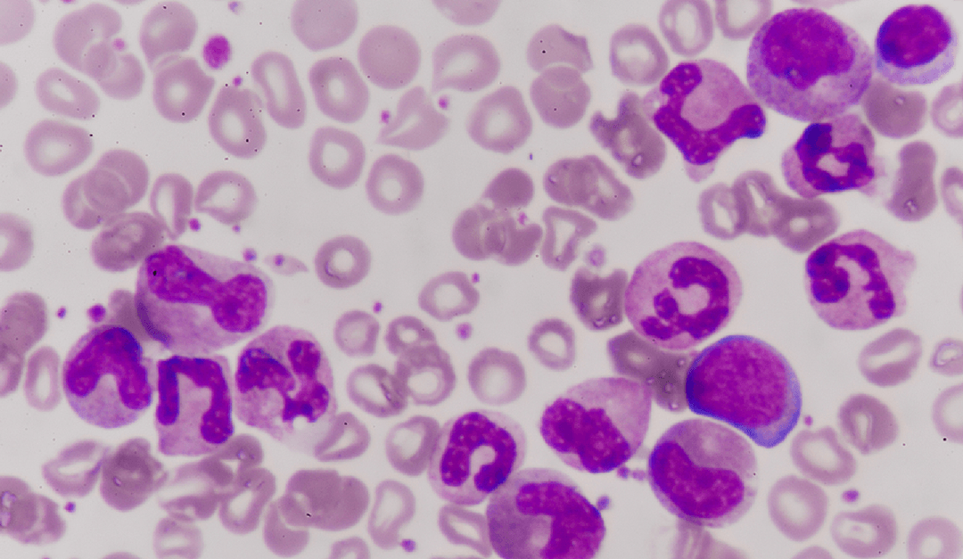 Odkryto rzadkie komórki, które mogą przemienić się w białaczkę. Mamy je wszyscy