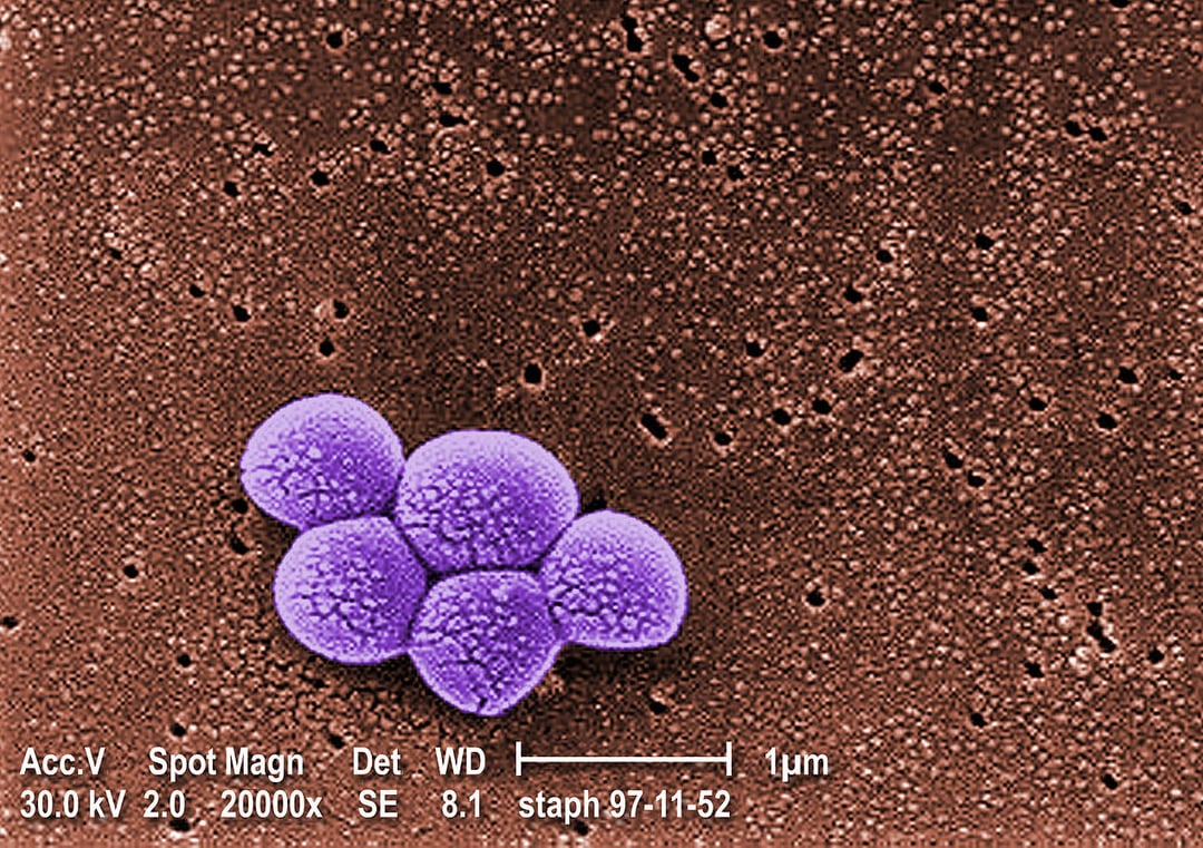 Groźny szczep MRSA może przeskoczyć ze świń na ludzi. Nie ma na niego leku