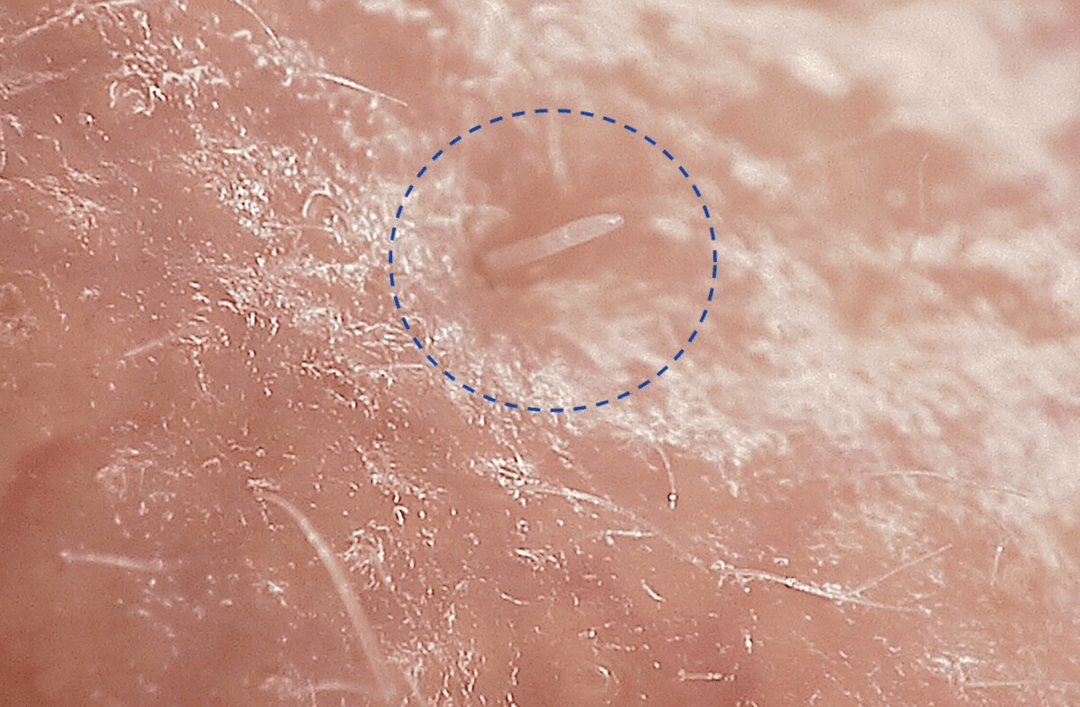 Żyją po cichu, kopulują w nocy. Sekretne życie nużeńców