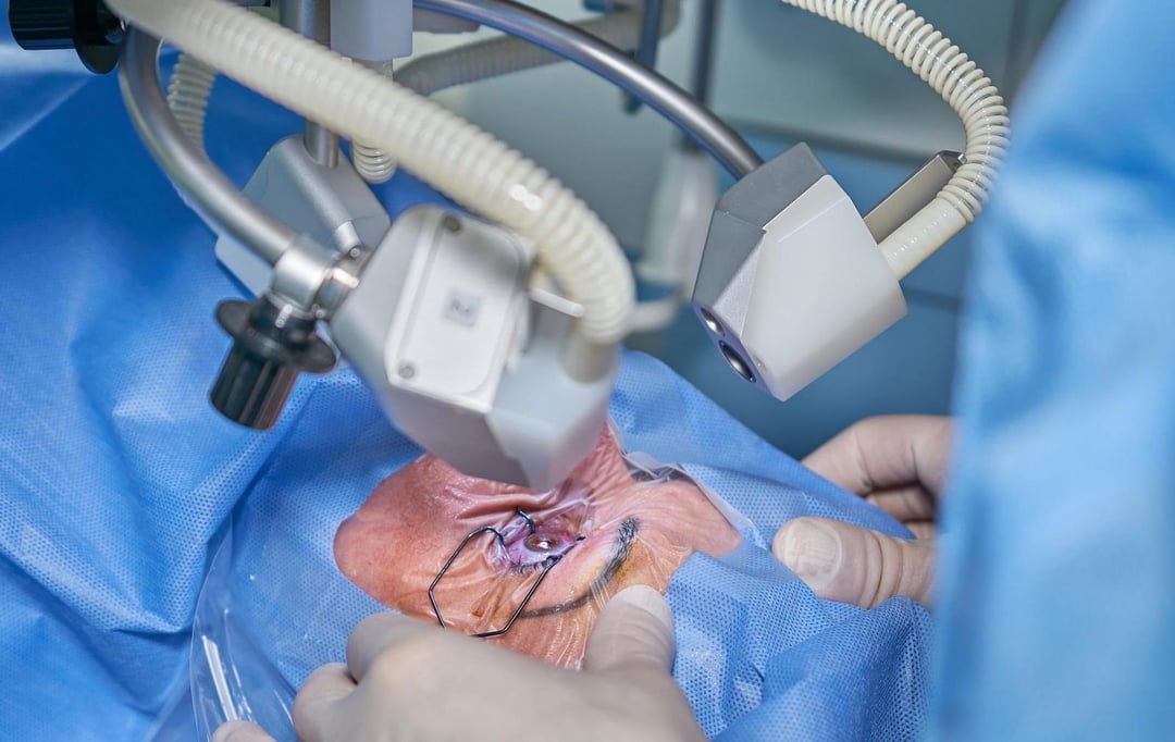 Zaćma nie ma szans. Nowa, jeszcze dokładniejsza metoda przywracania prawidłowego widzenia