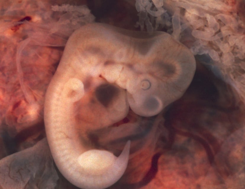 Dlaczego sprowadzenie na świat dziecka jest tak trudne?