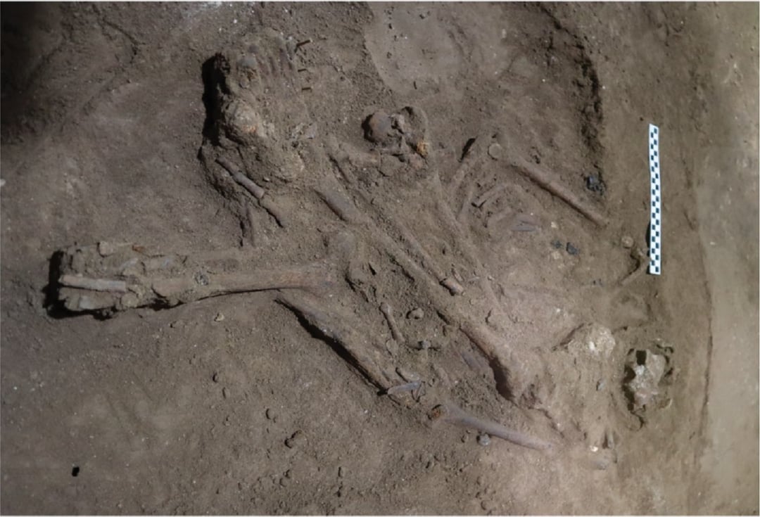 Wykonywali operacje już tysiące lat temu. Niesamowite ustalenia archeologów