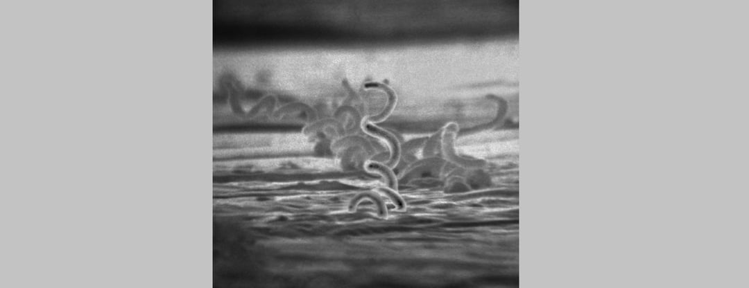 Jej twarz zniszczyła przerażająca choroba. Możemy zobaczyć skutki, choć chora żyła 500 lat temu