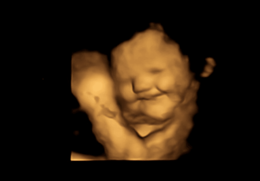 Nienarodzone dzieci nie lubią jarmużu. W końcu potwierdzono, jak reagują na smak pokarmów matki