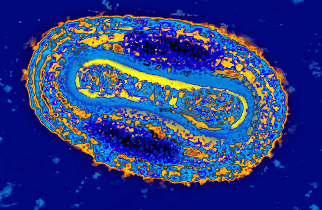 Ospa jest starsza, niż myśleliśmy. Ten wirus zabijał już w starożytnym Egipcie