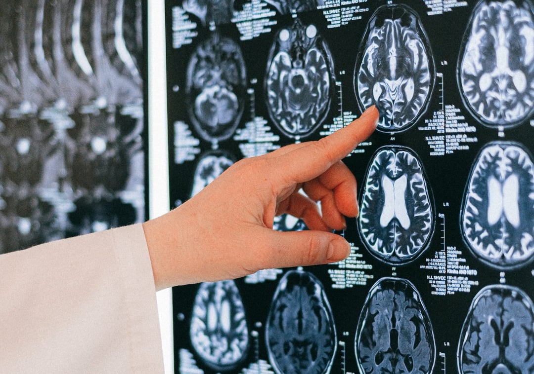 Uległ wypadkowi i zaczął widzieć świat “od tyłu”. Kim był Pacjent M?