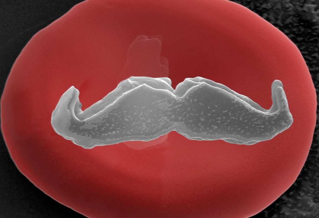 Najmniejsze wąsy świata. Nie uwierzysz, gdzie się pojawiły