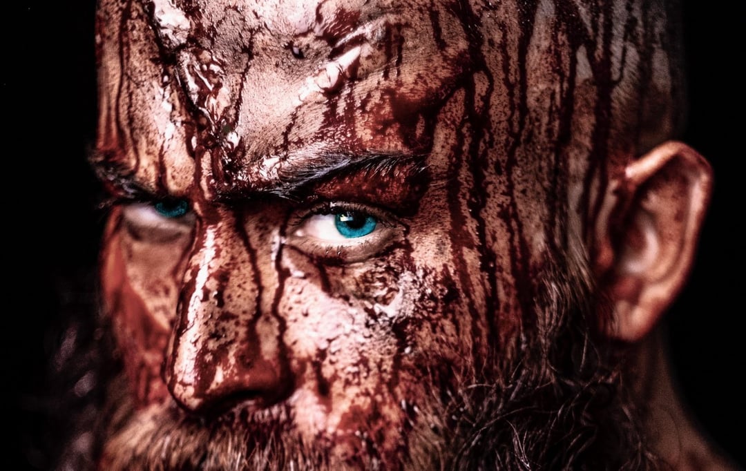 Wikingowie nie byli niezniszczalni. Borykali się z powszechną dziś przypadłością