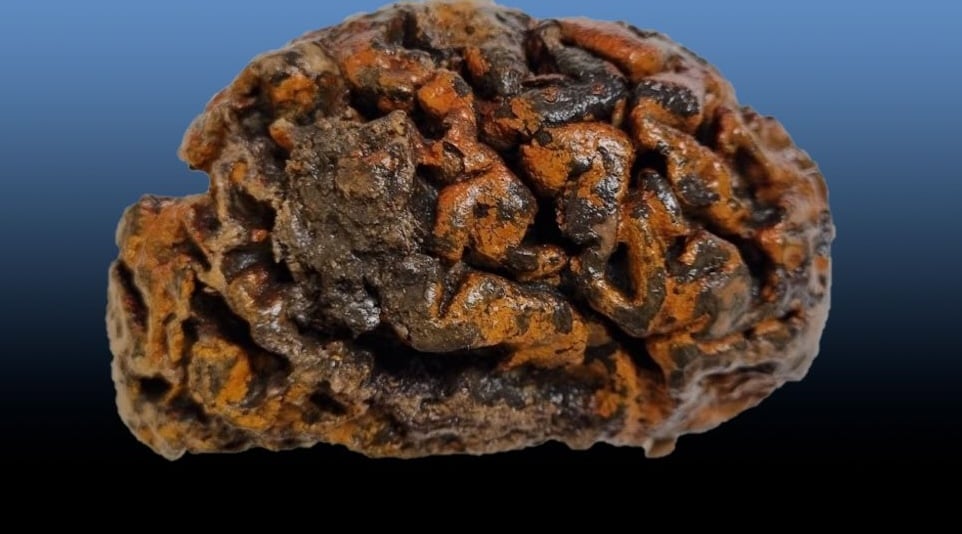 Ludzkie mózgi sprzed 12 tysięcy lat zaprzeczają przypuszczeniom naukowców