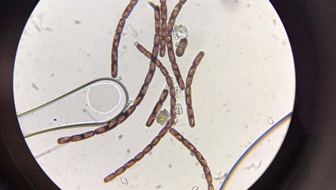 Na Grenlandii znaleziono olbrzymie wirusy. Mogą pomóc opanować skutki zmian klimatu