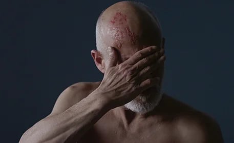 Połpasiec oczny. Pacjencki horror z happy endem