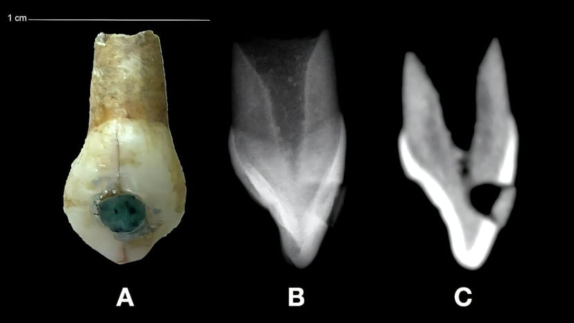Trzy zęby z muzeum wywróciły wiedzę o Majach do góry nogami. Stomatologia sprzed wieków zaskakuje archeologów
