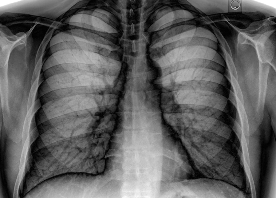Perowskitowa kamera pozwala zajrzeć do ludzkiego wnętrza. Technologia przyszłości już działa