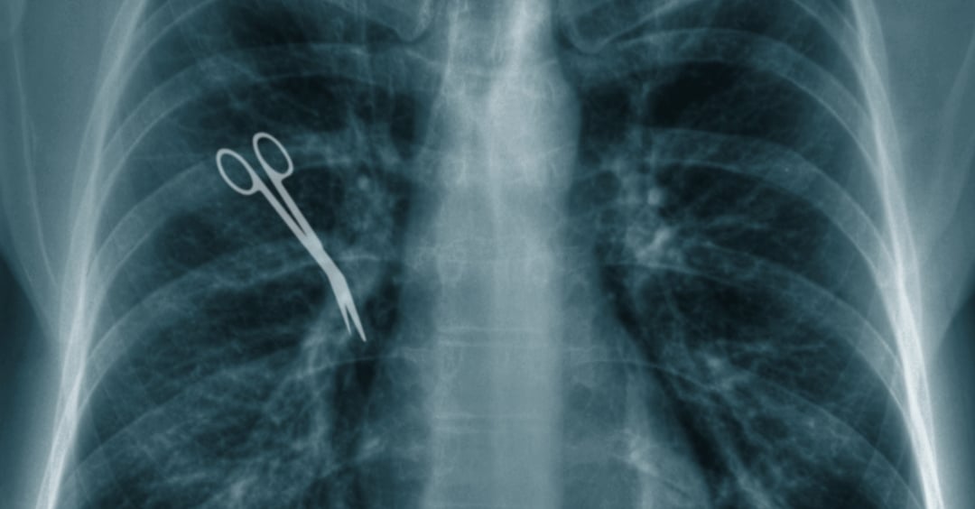 Gąbki, igły, nożyczki. Lekarze zostawiają w ciałach pacjentów tzw. pamiątki