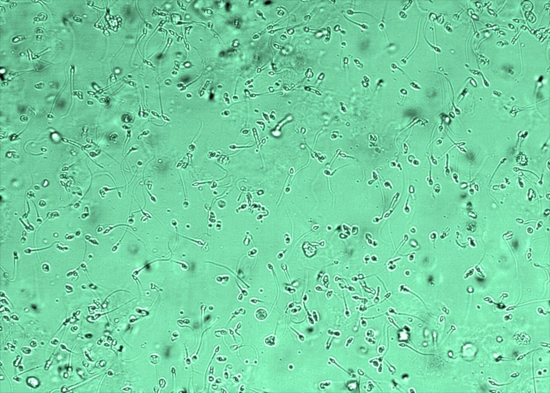 Nowa struktura w spermie. Może być odpowiedzialna za niepłodność, poronienia i wady u płodu