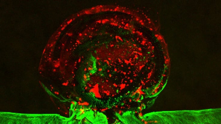 Stworzono ”żywego” tętniaka poza ciałem człowieka. Z krwi i komórek mózgu