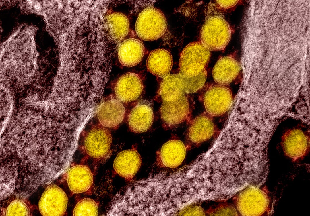 Ukryty gen w SARS-CoV-2. ”Chował się” wewnątrz innego