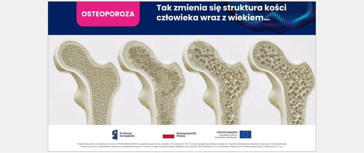 zmiana struktury kości człowieka wraz z wiekiem
