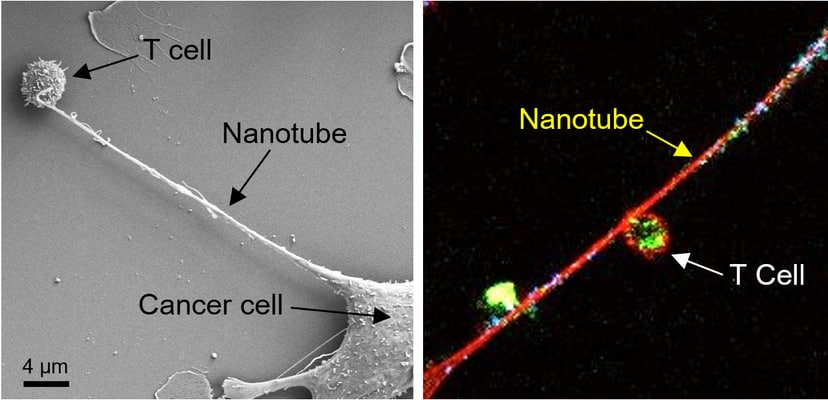 komorki-nowotworow-tworza-macki-zeby-krasc-energie-tak-bronia-sie-przed-ukladem-odpornosciowym-fot-nature-nanotechnology-https-doi-org-10-1038-s41565-021-01000-4