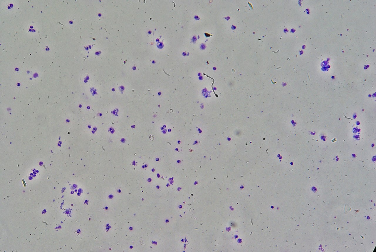 Ten pasożyt wpływa na ludzką atrakcyjność. Ma go nawet połowa z nas