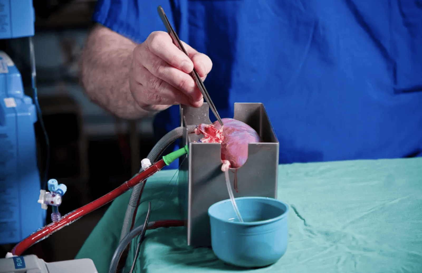 Czy można zmienić grupę krwi narządu pobranego do przeszczepu? Są na to szanse /Fot. University of Cambridge
