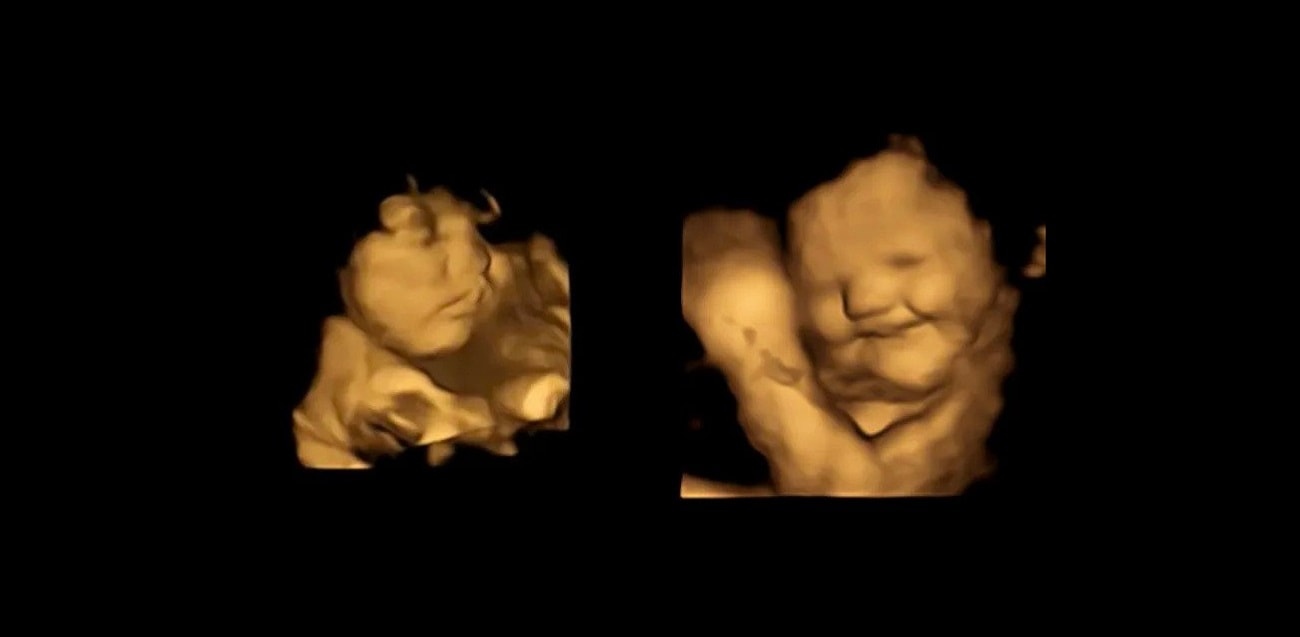 Niechęć do części jedzenia ludzie mają we krwi. Wykazujemy ją już w łonie matki