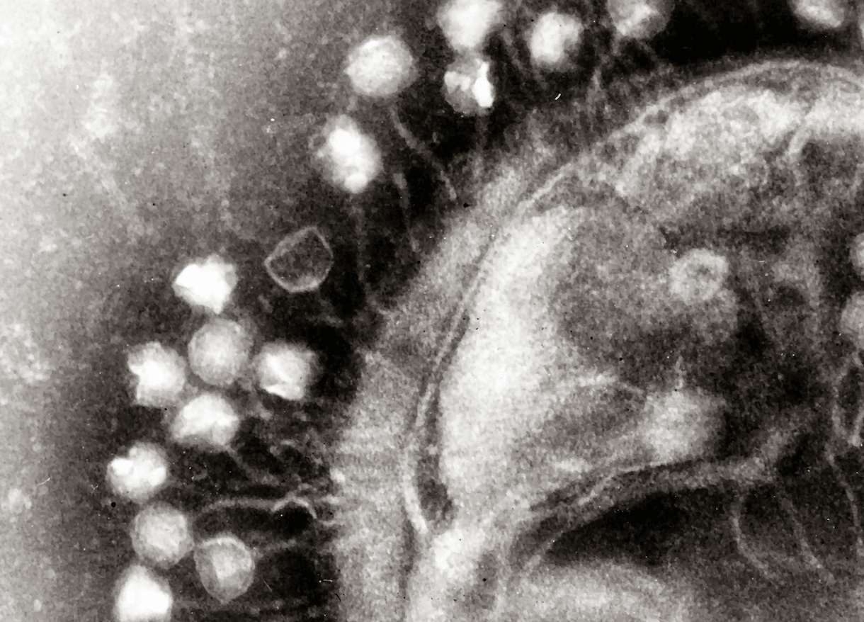 Niektóre wirusy mogą atakować bakterie (bakteriofagi), a inne je chronić – na zdjęciu pierwszy z przykładów /Fot. Wikipedia Commons
