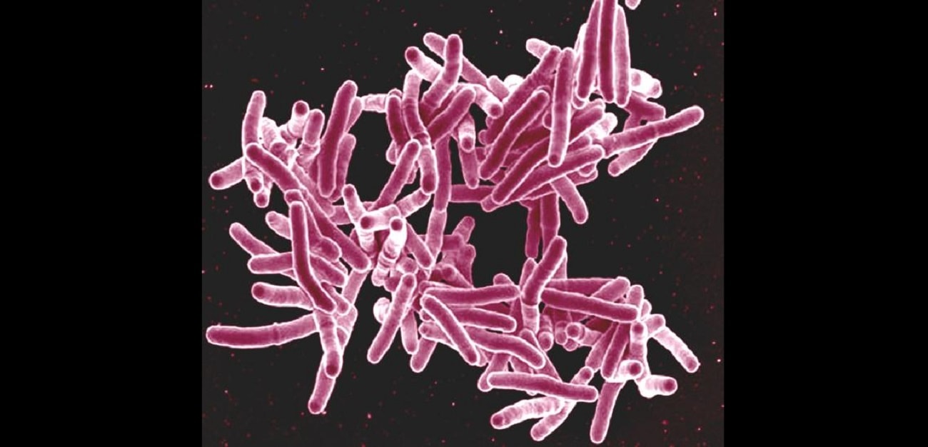 Ten patogen niszczy nasze kości. Okazało się, że krąży od tysięcy lat