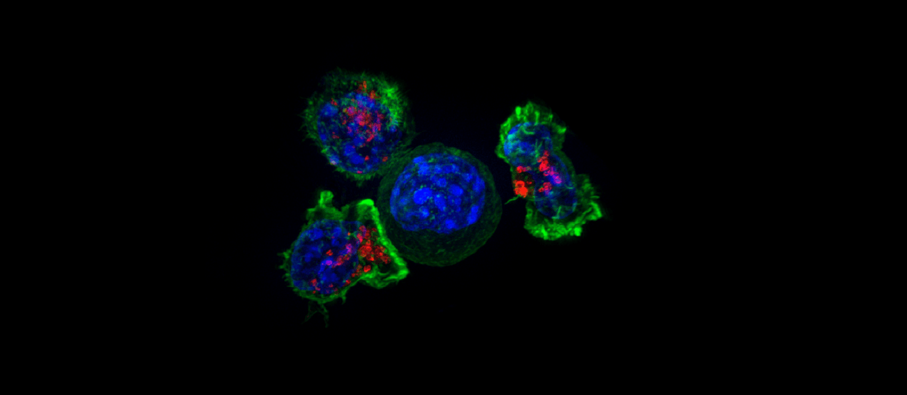 Ma 36 lat i 12-krotnie zachorowała już na raka. Niezwykły przypadek ze świata medycyny