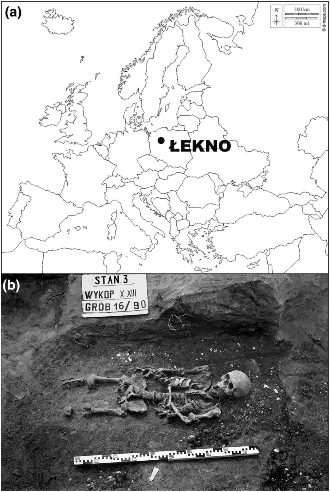 Średniowieczny mieszkaniec Polski cierpiał na niecodzienną przypadłość. Jego szczątki znaleziono w jednej z wsi
