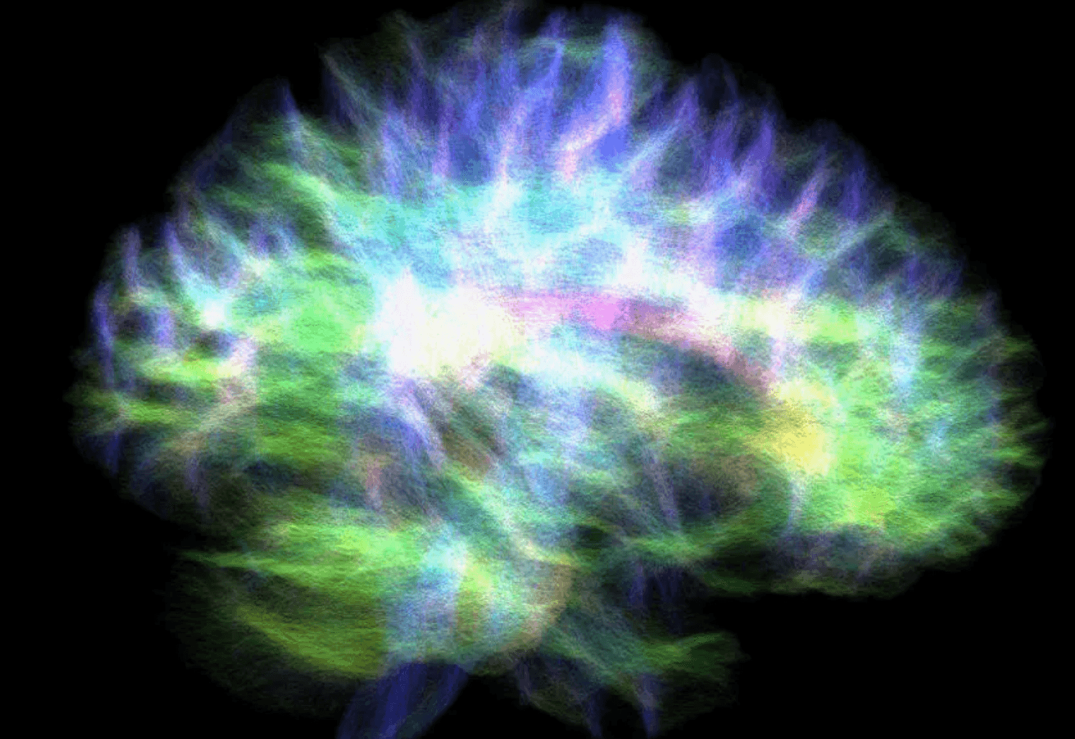 Schemat pokazujący połączenia biegnące do hipokampa /Fot. University of Sydney
