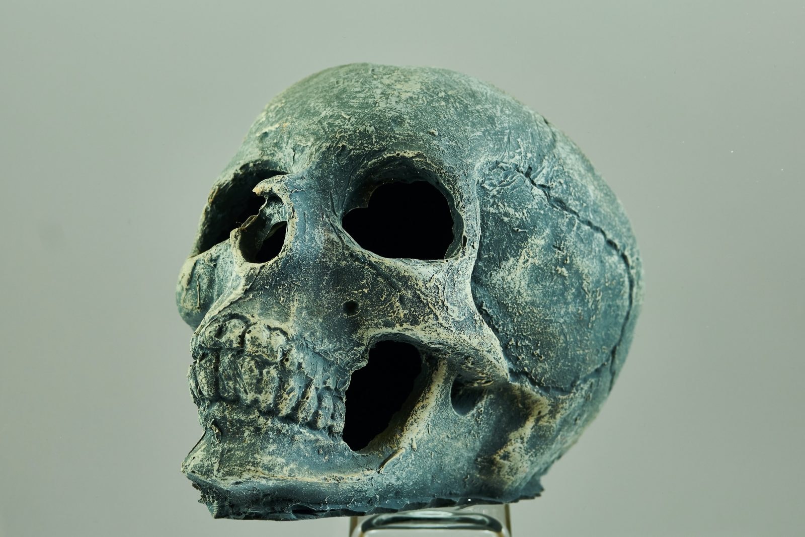 Czaszka kobiety nosi ślady niejednej operacji. Aż dziw bierze, że takie zabiegi wykonywano 1500 lat temu