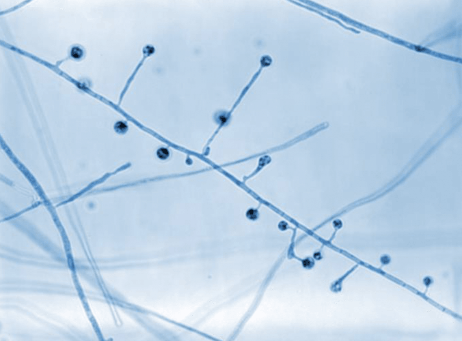 Blastomyces dermatitidis pod powiększeniem 800x – widoczne liczne konidiofory (szczytowe strzępki grzybni) /Fot. CDC
