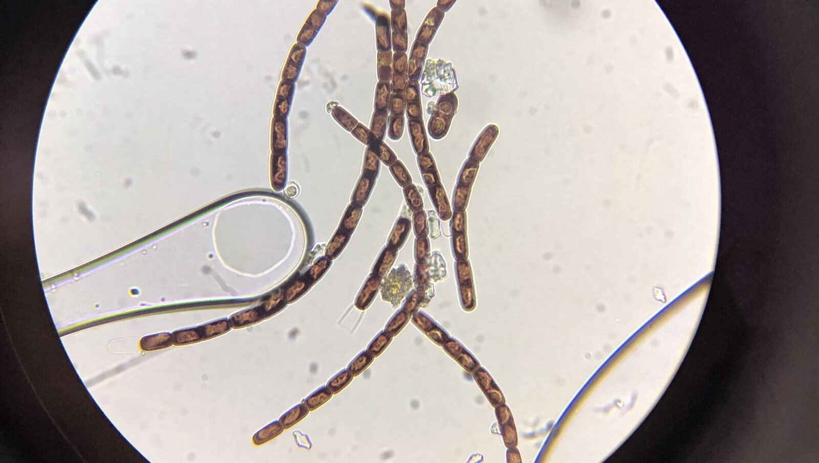 Olbrzymie wirusy jeszcze nie były oglądane pod mikroskopem, ale nie jest to niemożliwe. Tu inne organizmy z Grenlandii /Fot. Laura Perini
