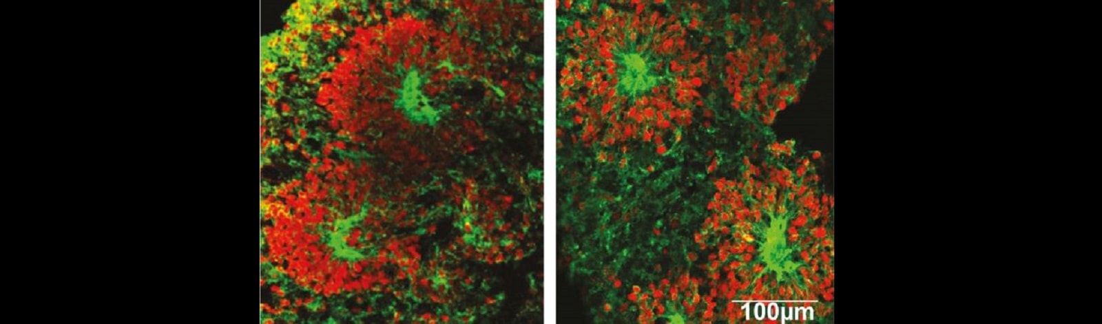 Ludzkie minimózgi trafiły w kosmos. Tam stało się z nimi coś niespodziewanego