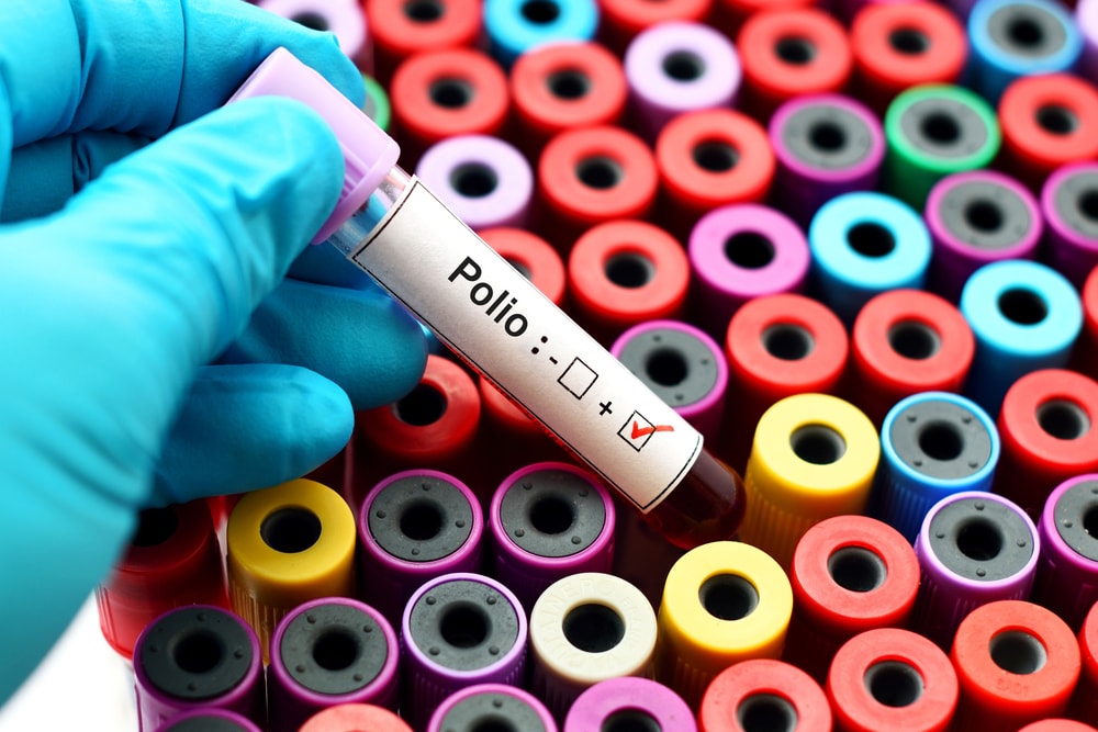 Czy polio może znów nam zagrozić?
