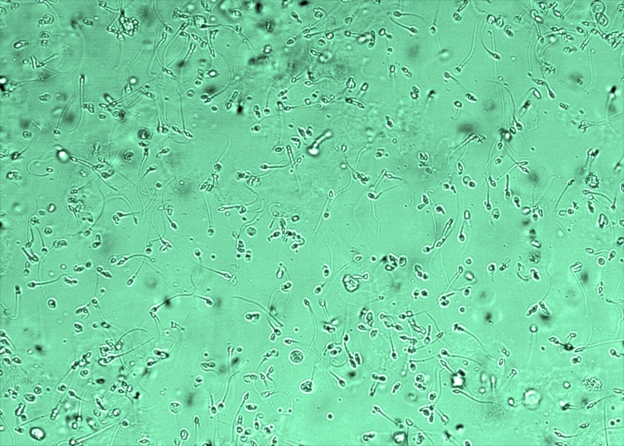 Nowa struktura w spermie. Może być odpowiedzialna za niepłodność, poronienia i wady u płodu