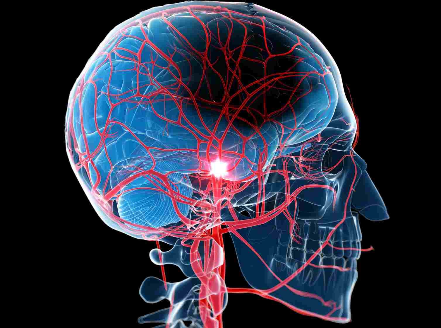 Jak umiera mózg? Wciąż tego nie wiemy
