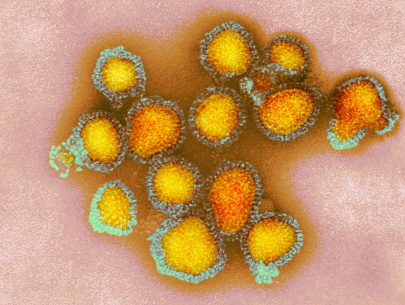 czasteczki-wirusa-grypy-h3n2-ten-typ-jest-najbardziej-zroznicowany-fot-getty-images
